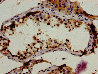 RBP1 Antibody