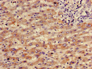 RBP4 Antibody, Biotin conjugated