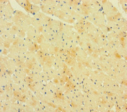 RCAN1 Antibody