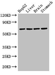 RCBTB2 Antibody