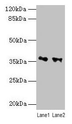 RDH11 Antibody