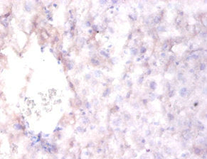 RELN Antibody