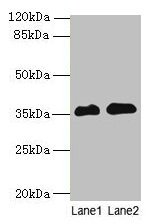 RFPL3 Antibody