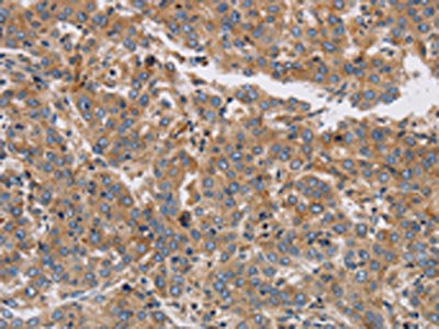 KCNG1 Antibody