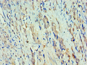 RFX5 Antibody