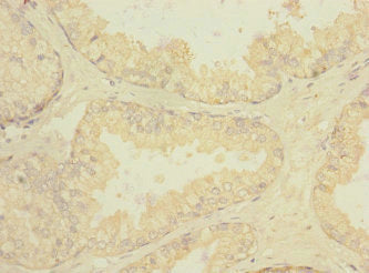 RGR Antibody