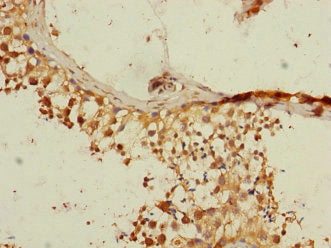 RGS14 Antibody