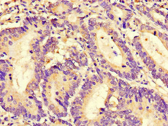 RGS4 Antibody
