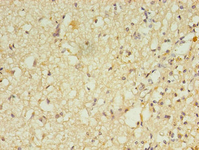 RGS7 Antibody