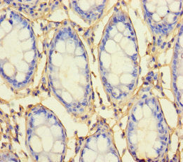 RHBDL2 Antibody