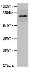 RHOBTB1 Antibody
