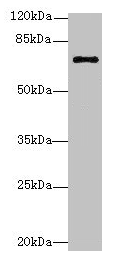RHOBTB3 Antibody