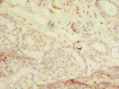 RHOC Antibody
