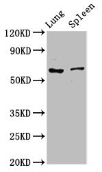 RIPK2 Antibody