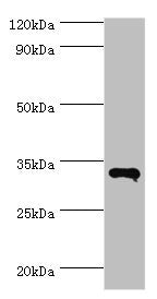 RNF212 Antibody