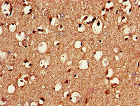 RNF40 Antibody