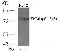 Phospho-PRKCD (Ser645) Antibody