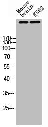 ATM Antibody