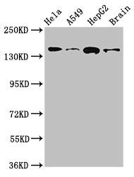 ROCK2 Antibody