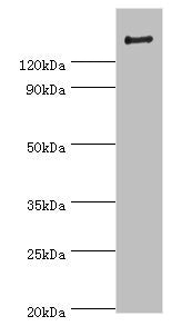 ROCK2 Antibody
