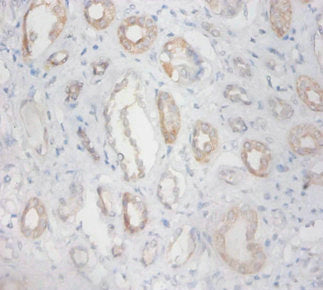 ZNF91 Antibody