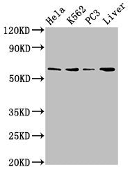 RORA Antibody