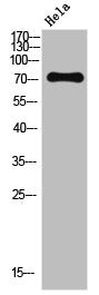 Phospho-NF2 (S518) Antibody