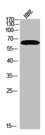 Phospho-NF2 (S10) Antibody