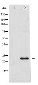 TIMP1 Antibody