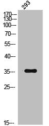Phospho-NFKBIB (T19) Antibody
