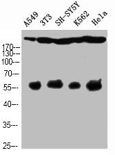 Cleaved-NOTCH4 (V1432) Antibody