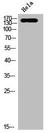 Phospho-NTRK3 (Y516) Antibody
