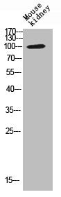 TNNI3K Antibody
