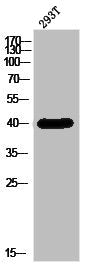 ZDHHC9 Antibody