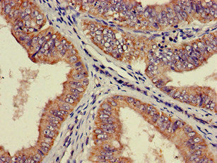 RPS21 Antibody
