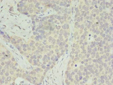 RPS28 Antibody