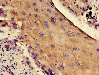 RPS4Y1 Antibody
