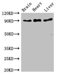 RPS6KA5 Antibody