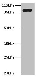 RRM1 Antibody