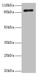 RRM1 Antibody