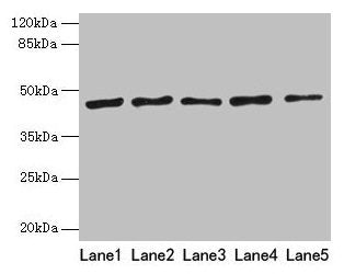 RRM2 Antibody