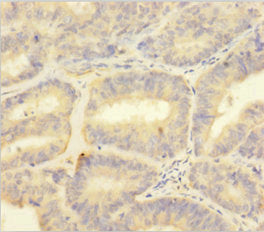 S100A1 Antibody