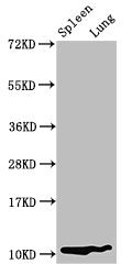 S100a8 Antibody