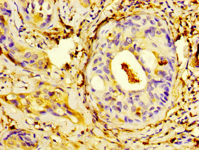 S100A9 Antibody