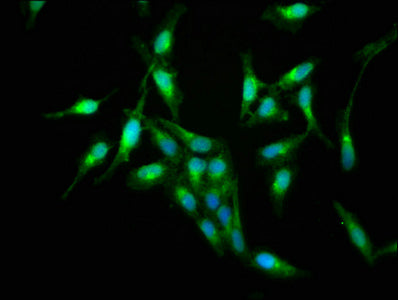 S100A9 Antibody