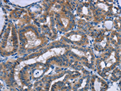 PLIN1 Antibody