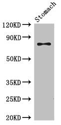 SCIN Antibody