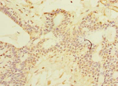 SCNM1 Antibody
