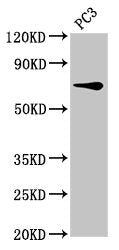SCNN1B Antibody