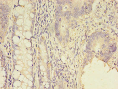 SCNN1G Antibody